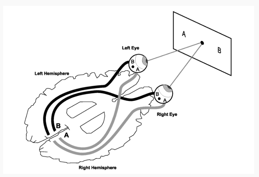 Visual pathway showing contralateral processing